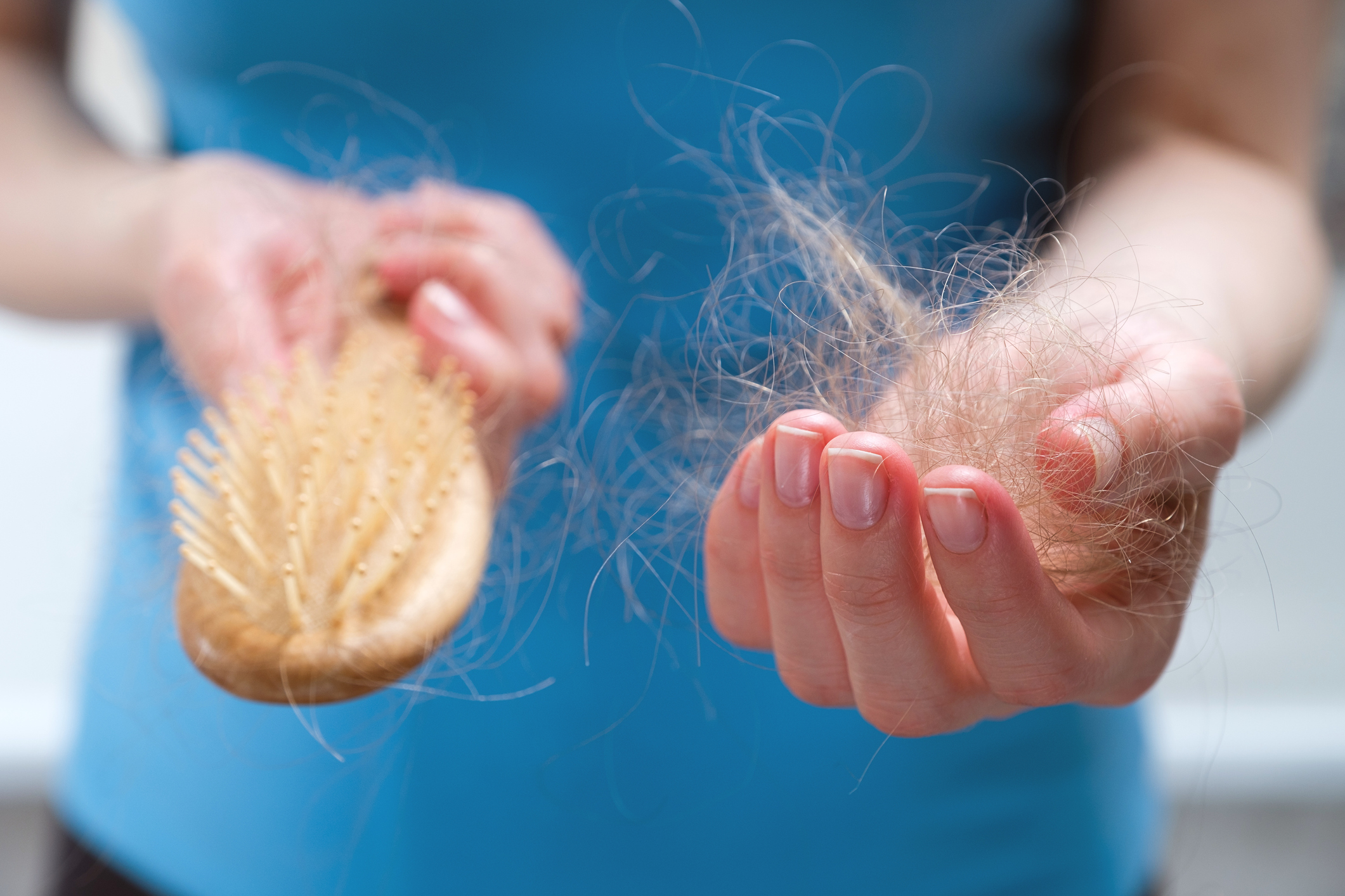 There's No Shame In Female Hair Loss